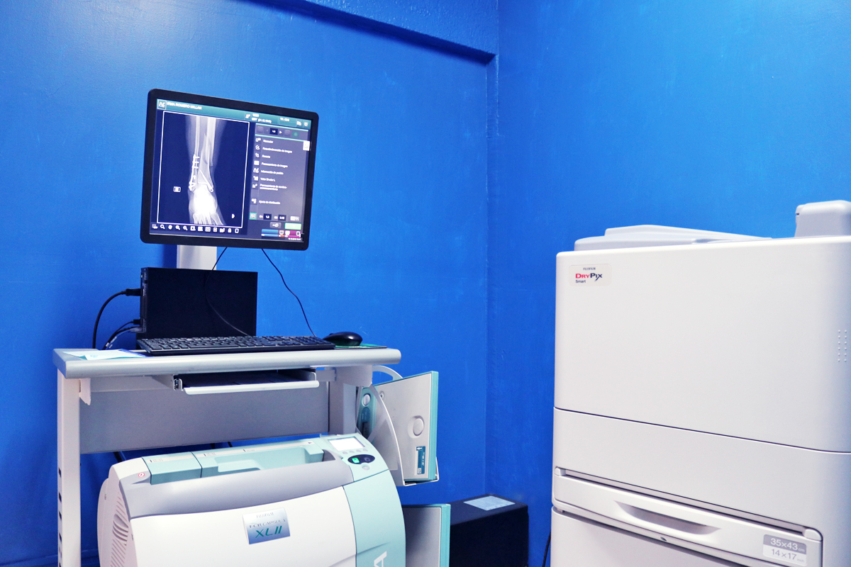 Como apoyo al médico y paciente, podemos realizar estudios de Rayos X con digitalizador de imagen, Ultrasonido convencional y Doppler por personal calificado. Además de contar con convenios para Tomografía y Resonancia magnética.